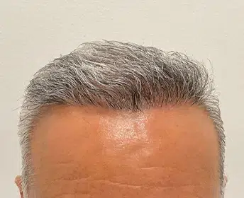 HAIR SPECIALIST